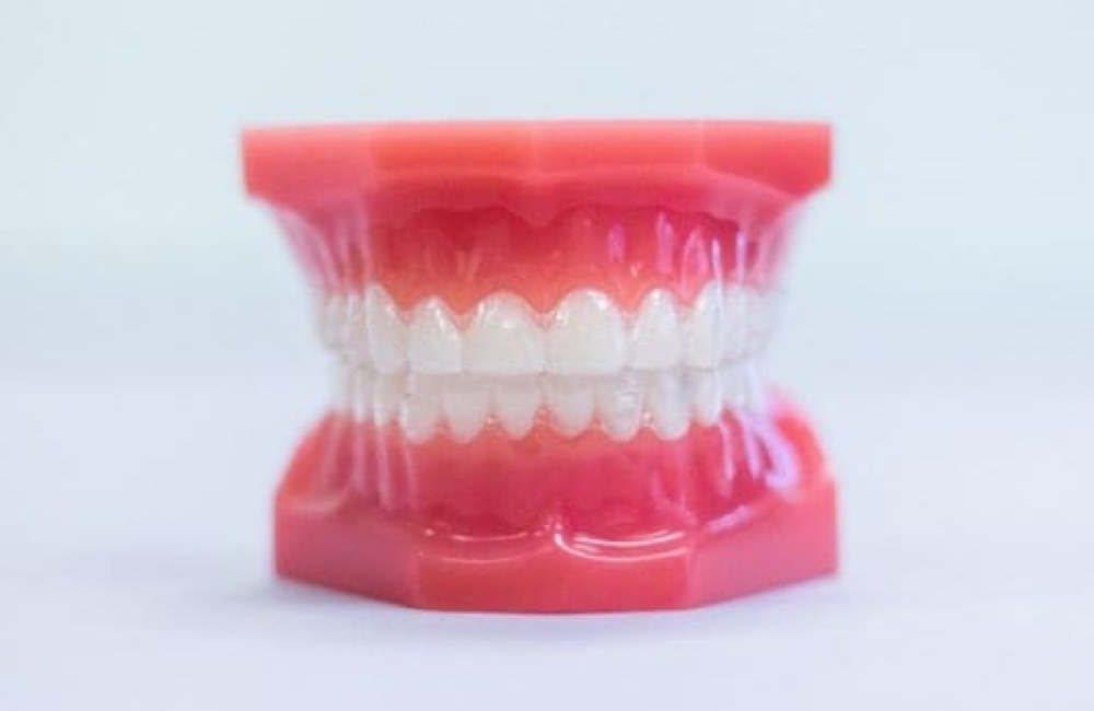 invisalign aligners on plastic model