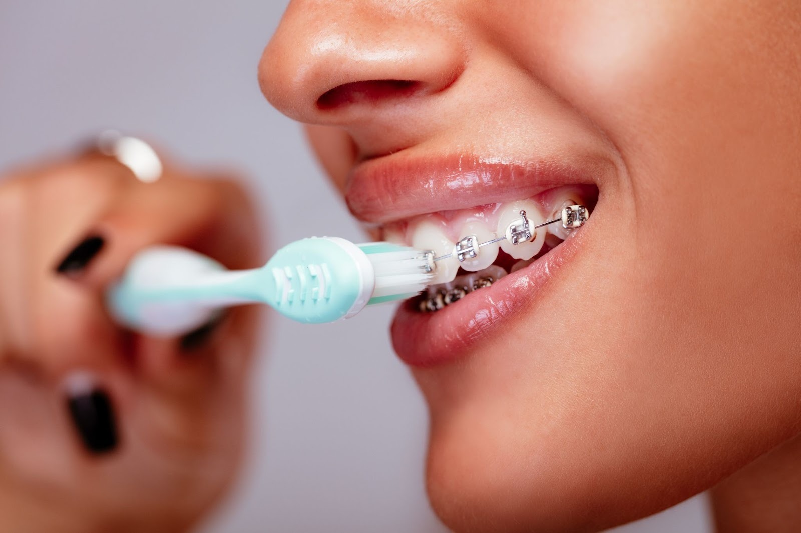 How To Keep Your Teeth Clean With Braces