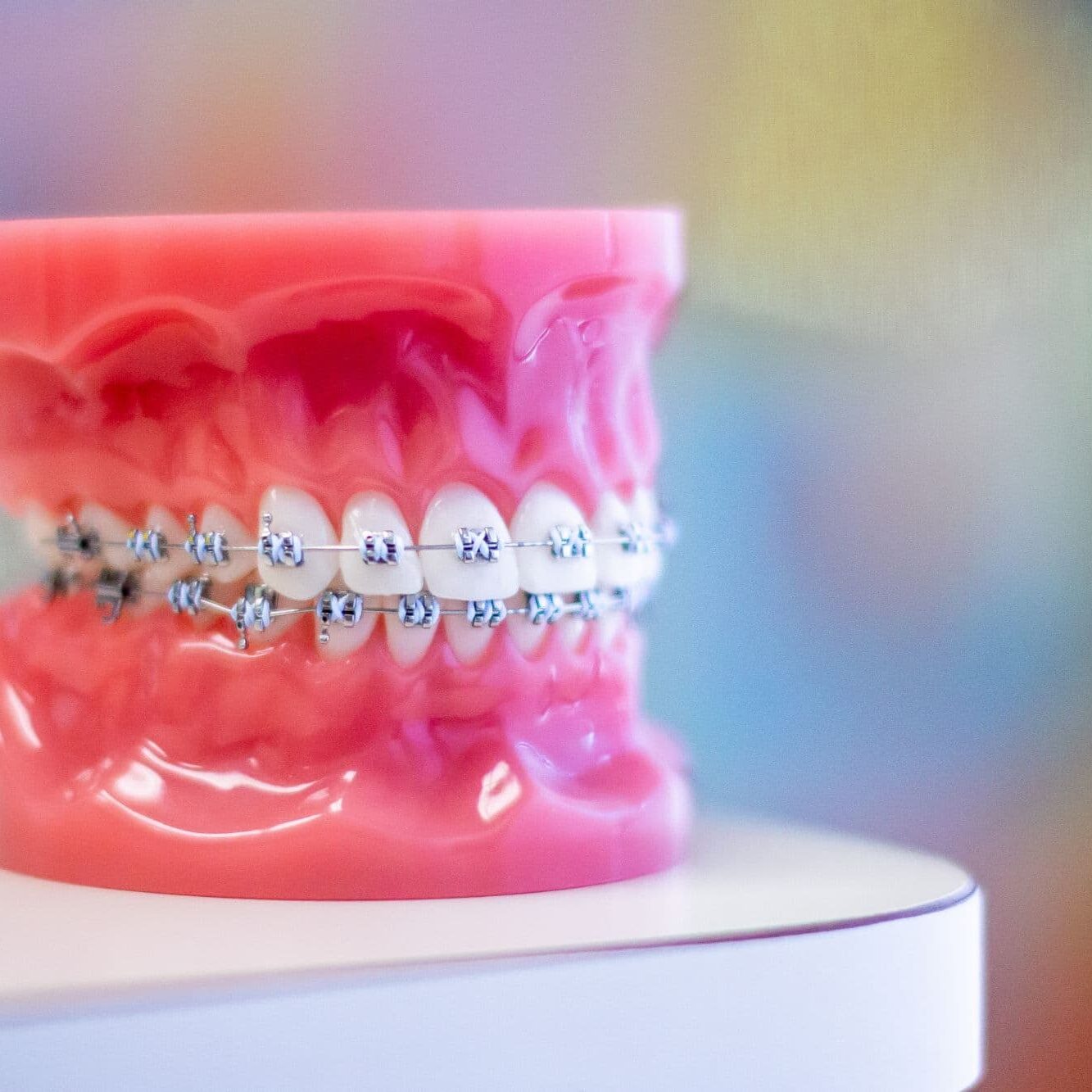 richmond braces