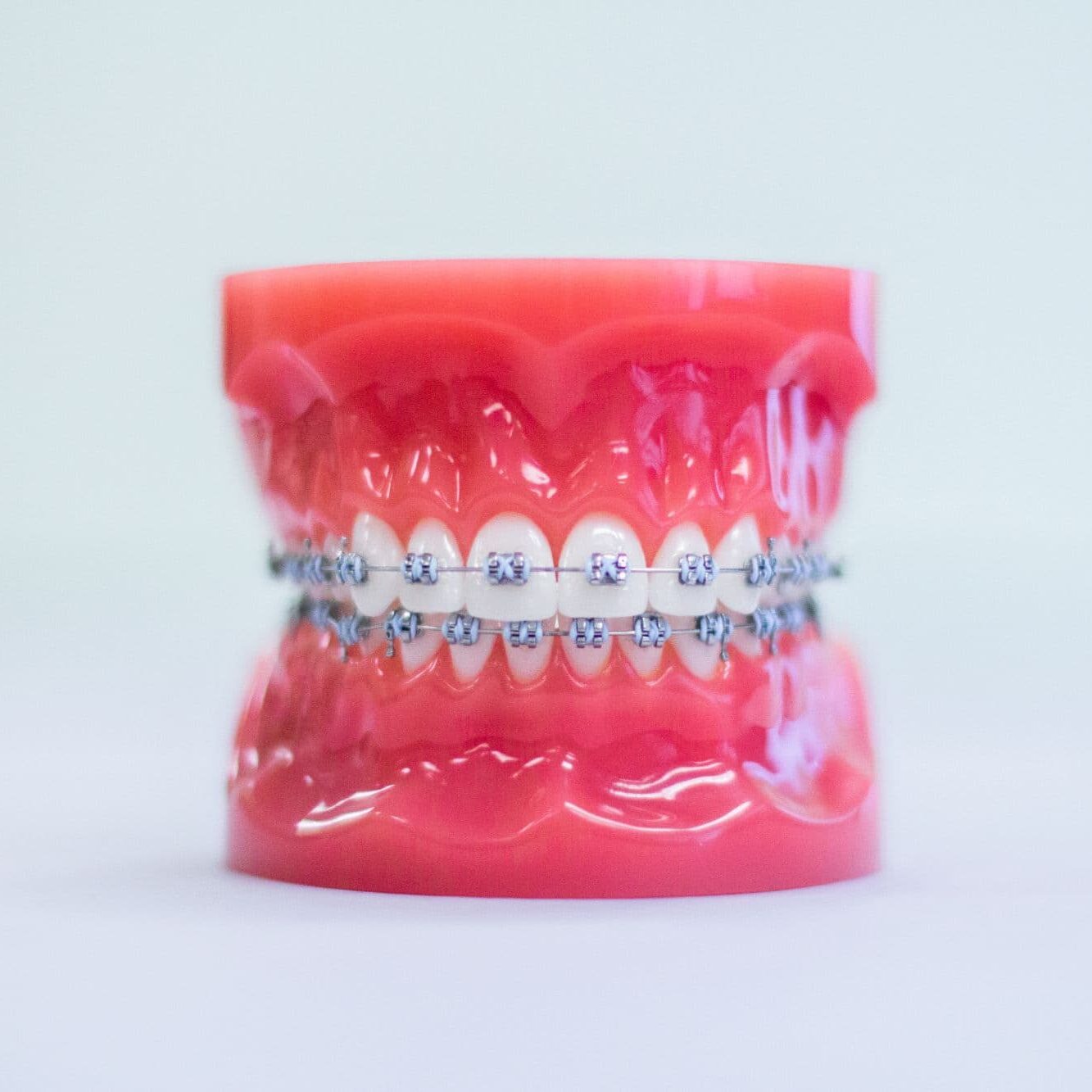 braces richmond