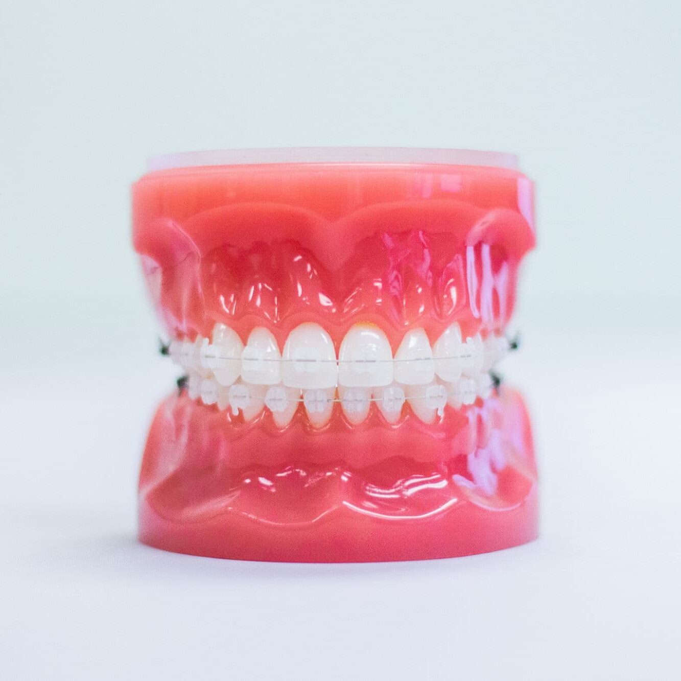 richmond clear braces